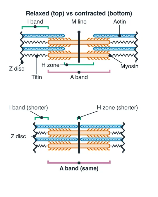 An AI-drawn diagram of a sarcomere relaxed and contracted, with the Z disc, I band, A band, H zone, M line, actin, myosin and titin labeled.